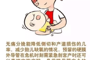 无痛分娩