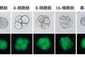 鲜胚移植