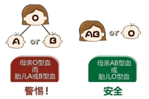 新生儿溶血