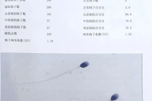 精子浓度